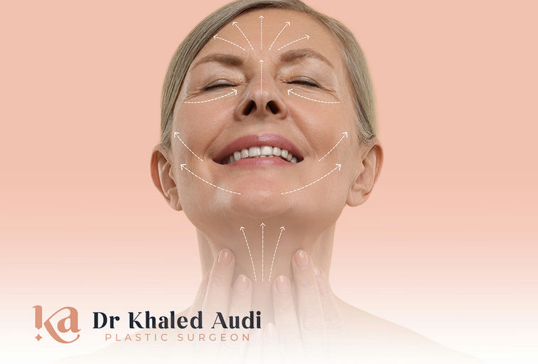 تقنية-نفرتيتي-ليفت