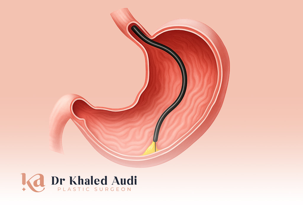 بوتوكس-المعدة