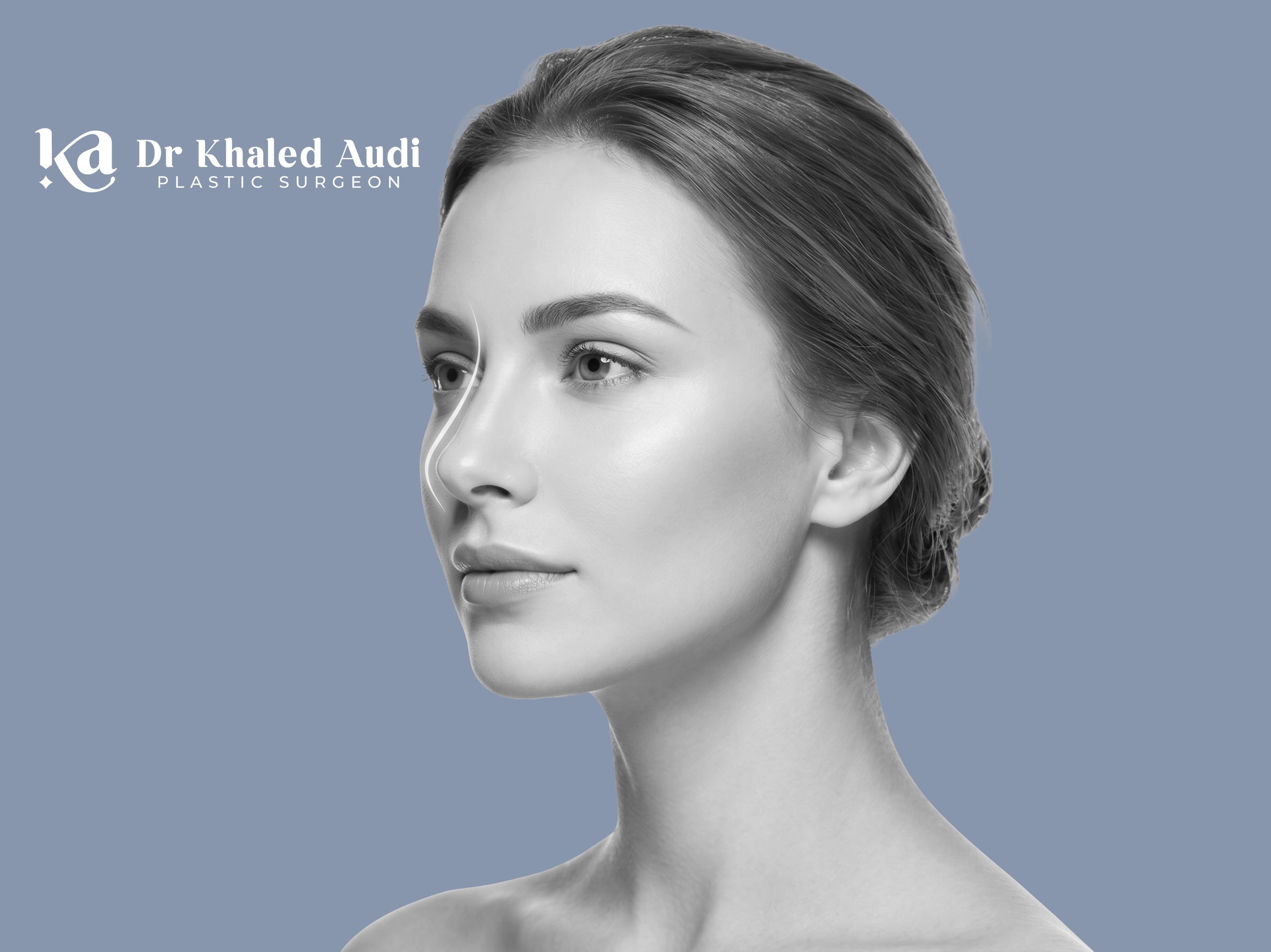 تجميل-الأنف-بالفيلر