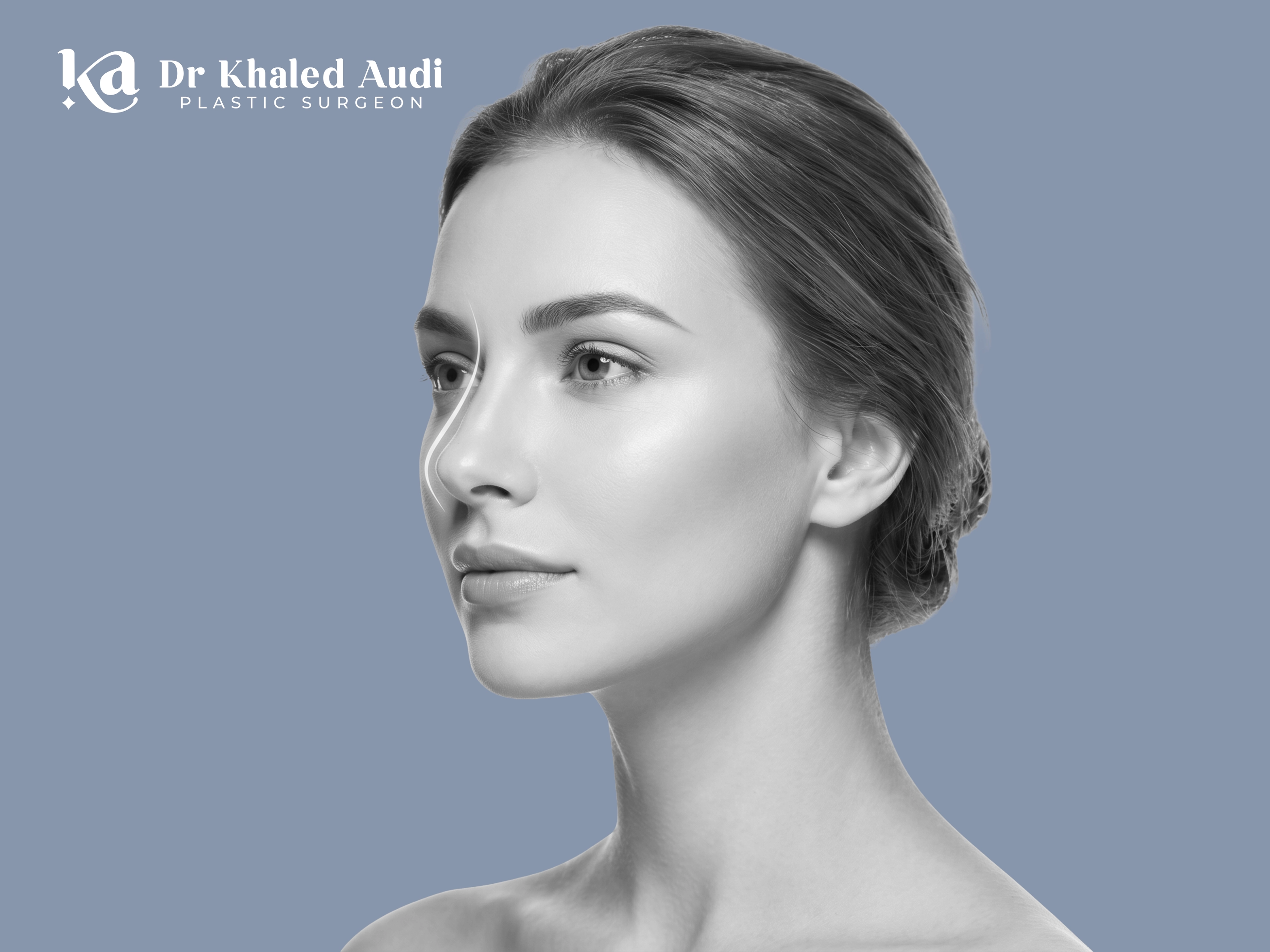 تجميل-الأنف-بالفيلر