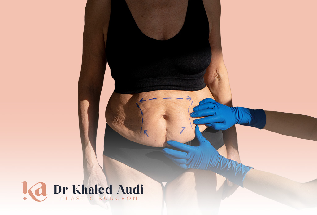 تصحيح-عمليات-تجميل