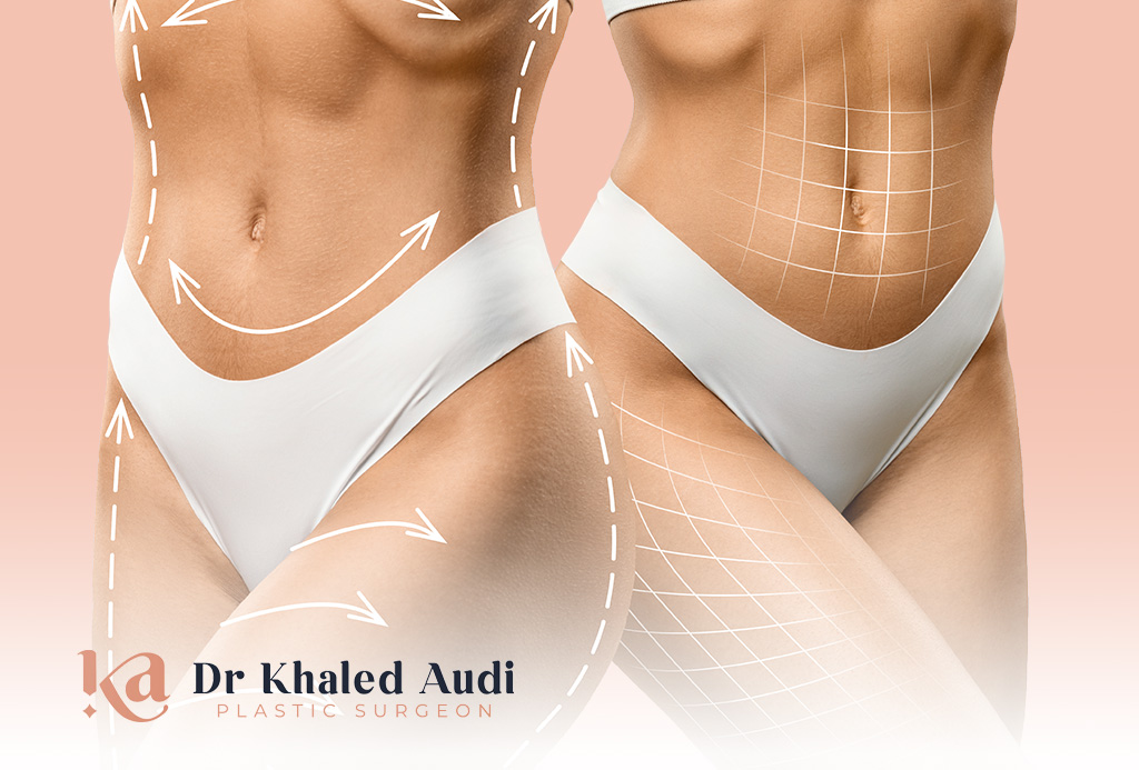 نحت-الجسم-رباعي-الأبعاد 4D-Liposculpture