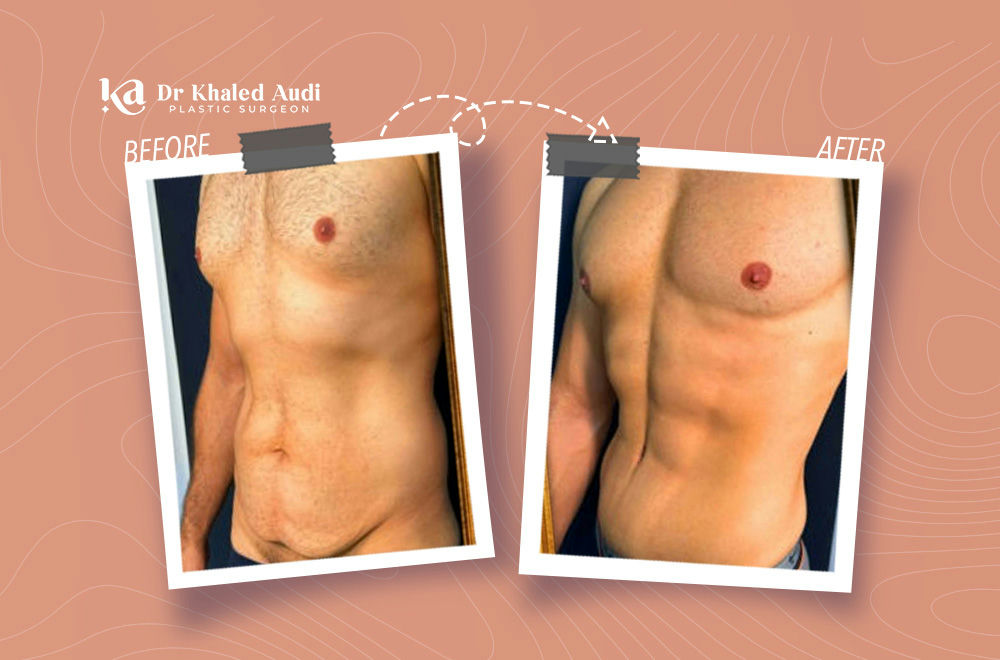 من-الإحباط-إلى-الثقة-مع-نحت-الجسم-رباعي-الأبعاد